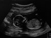 What kind of civilized nation allows babies to be dismembered?
